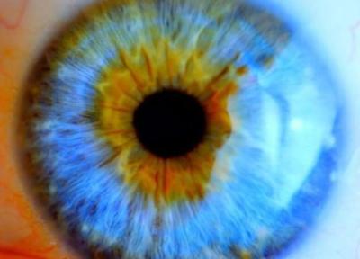 درمان نابینایی با یاری مینی چشم های آزمایشگاهی